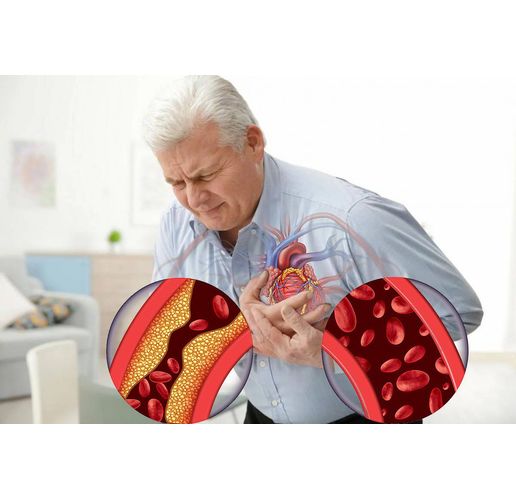 Сърдечно-съдови заболявания