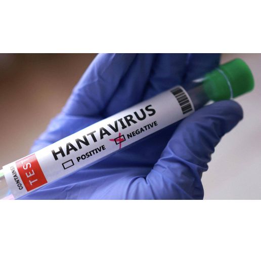 Хантавирус