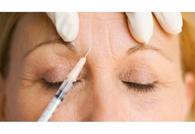 58 годишна жена беше задържана за поставяне на ботокс без съответната