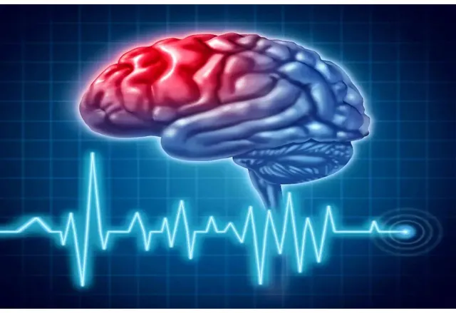 Световен ден за борба с инсулта
