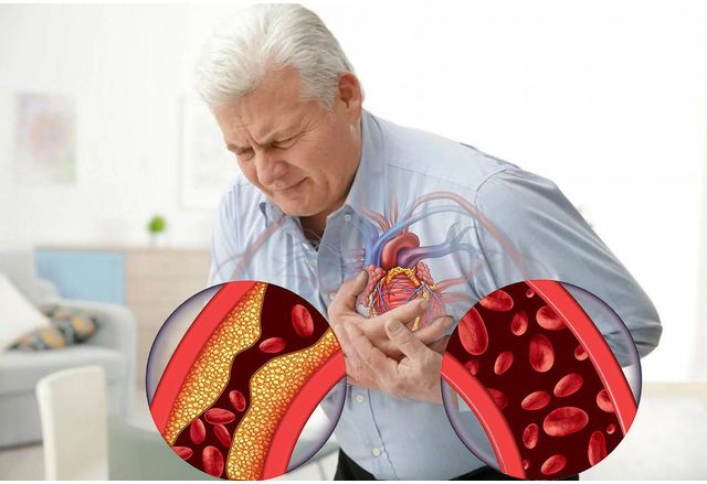 Европейската комисия ЕК представи плана Здрави сърца чиято цел е