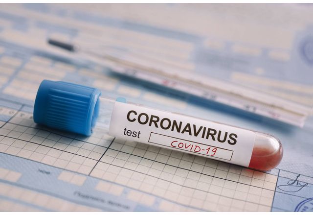 45 са новозаразените с коронавирус у нас за последното денонощие