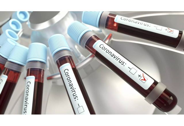 През изминалото денонощие в страната са регистрирани 704 нови случая