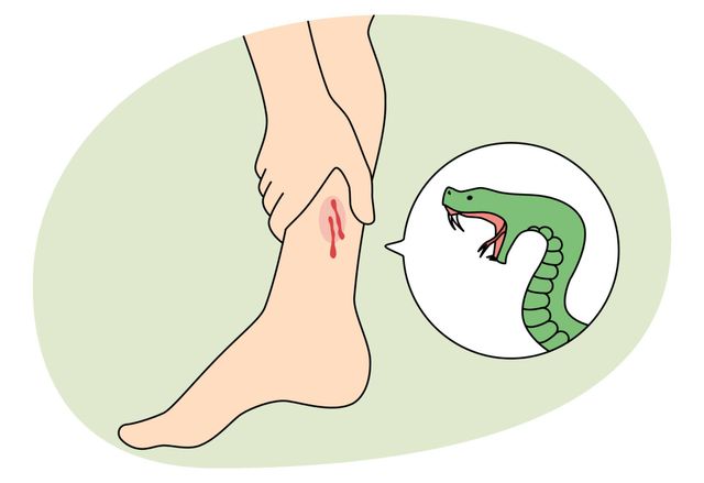 65 годишен мъж от Благоевград е транспортиран за столично заведение след