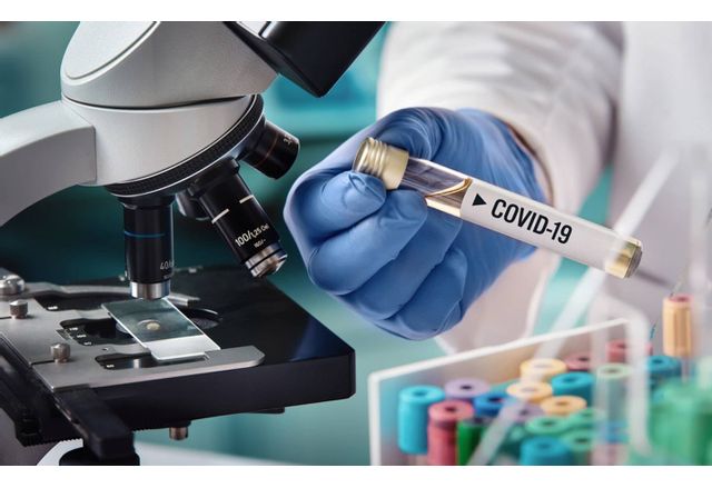 Новите потвърдени случаи на коронавирус са 290 сочат данните на