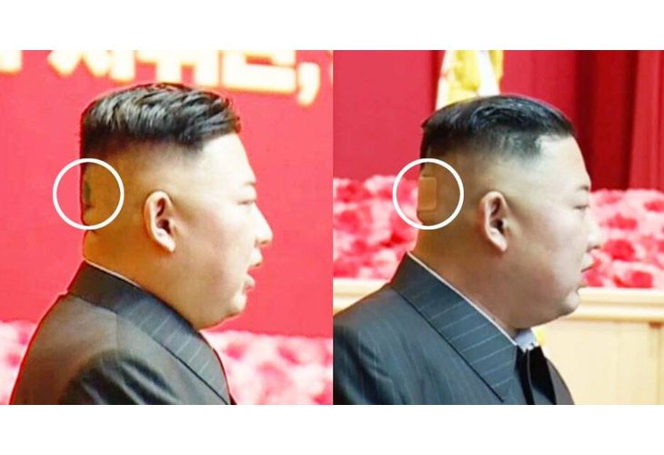 Лепенката на главата на Ким Чен Ун