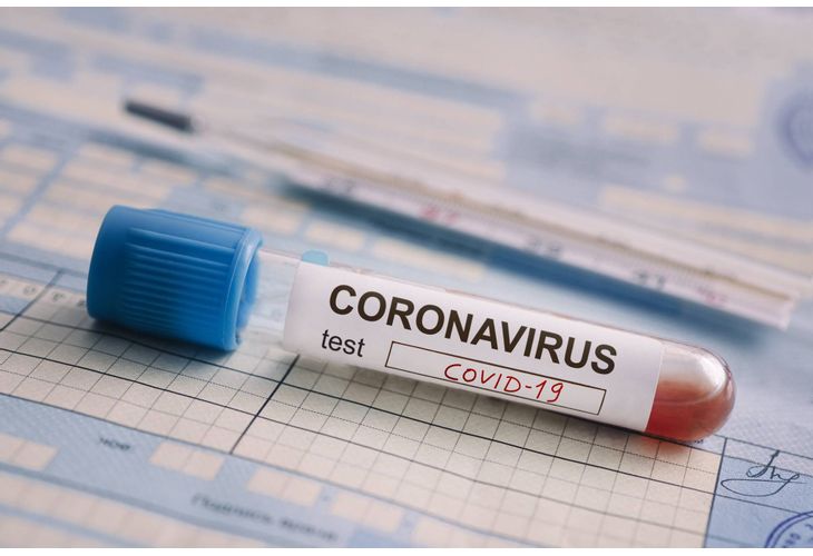 289 са новите случаи на коронавирус при направени 1791 теста.